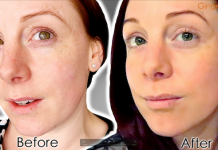 CACI Facial Review – My Non Surgical Facelift Experience Best Salon Chester